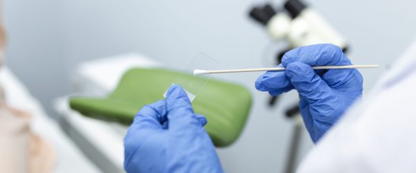 Vaginal Smear. Close-up of doctor hand holds gynecological examination instruments. Gynecologist working in the obstetrics and gynecology clinic.